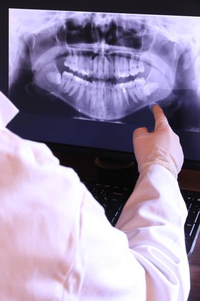 Best Emergency Dental Care for Broken or Chipped Teeth in Lake Leann, MI