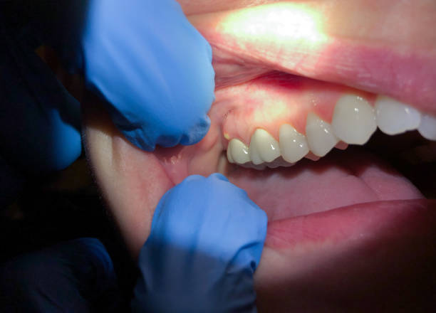 Best After-Hours Dental Trauma Care in Lake Leann, MI